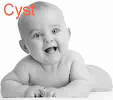 baby Cyst